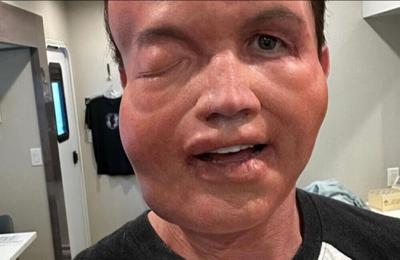 Rob McElhenney compared to Sloth after sharing image of ‘extreme allergic reaction’